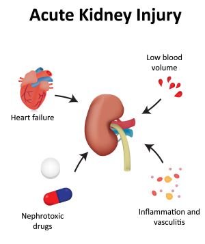 Predicting Nephrotoxic Acute Kidney Injury in Hospitalized Adults